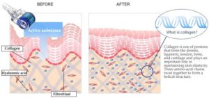 environ treatments