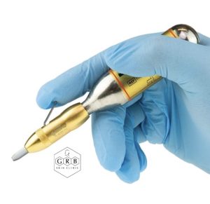 skin tag