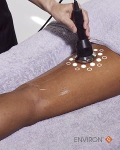 environ treatments